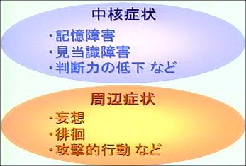 箇条書きの図：中核症状と周辺症状。文言は本文と同じ