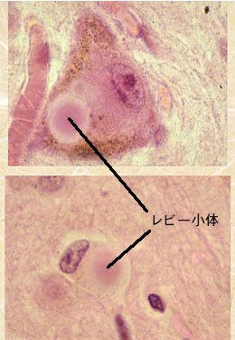 画像。内容は本文の通り。