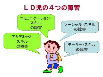 図：LDの特徴。内容は本文の通り