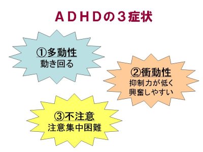 図：ADHDの特徴。内容は本文の通り。