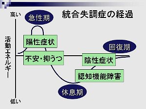 図：統合失調症の経過と症状。内容は本文と同じ